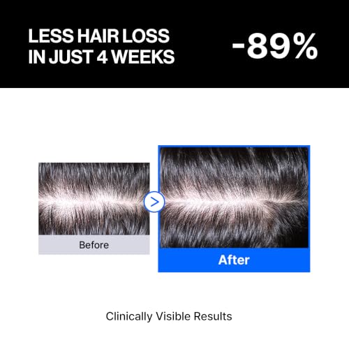 Refilled cADPR Hair Growth Serum for Thin Hair & Scalp Care