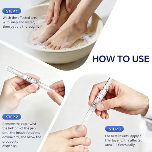 AOUGK Toenail Fungus Treatment Pen - 25% Undecylenic Acid, 4 Pack
