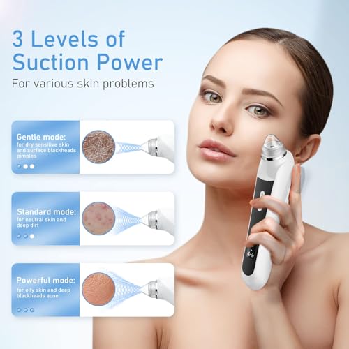 Ottleba HD Camera Blackhead Remover with 3 Suction Modes