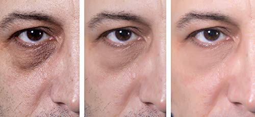 Anti-Aging Eye Gel for Dark Circles & Puffiness | 1.7 fl oz