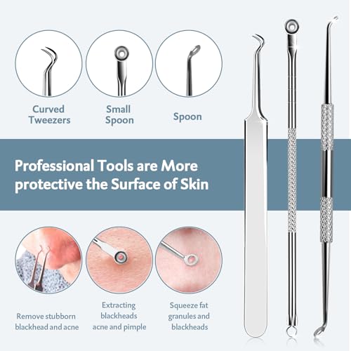 MENOLY 10-Piece Pimple Popper Tool Kit for Blackheads & Acne