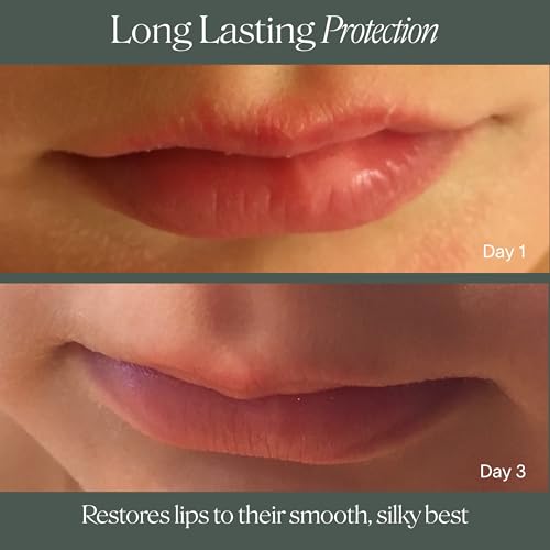 Doctor Rogers Lip Balm. Hydrating & Softening Lip Moisturizer for Very Dry Lips, Natural & Hypoallergenic, 0.15 Ounce (4.25 g), Pack of 3 tubes