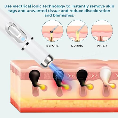Blue Light Therapy Pen for Acne, Scars, and Skin Tightening