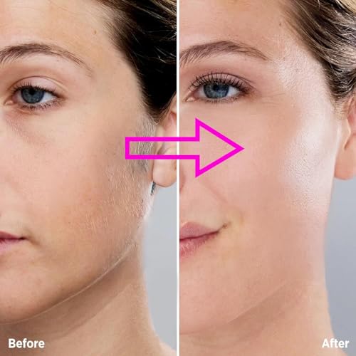 6 Pcs Replacement Heads for Flawless Gen 3 Facial Hair Remover - Hypoallergenic & Precise