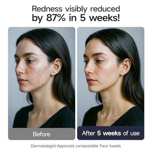 ECOLOOK Disposable Face Towel XL-60 Count Upgraded Thick Facial Towels, Ultra Soft Clean Face Towels Disposable, 10"x12" & 90 GSM, Ideal for Sensitive Skin?-1 PACK