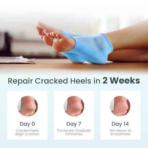 Moisturizing Heel Socks for Cracked Heel Treatment - Promifun 2 Pairs Moisturizer Socks for Dry Cracked Feet - Cracked Heel Repair - Heel Socks for Women & Men (Blue & Pink)