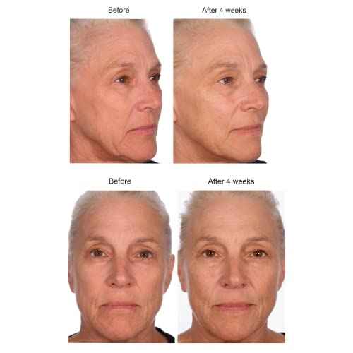 Serious Skincare - Black Pearl Deep Wrinkle Decrease Face Serum - Repair Deep Lines & Wrinkles - Increases Skin Hydration & Elasticity - Radiance Boosting for Luminous Glowing Skin 1 Fl. Oz.