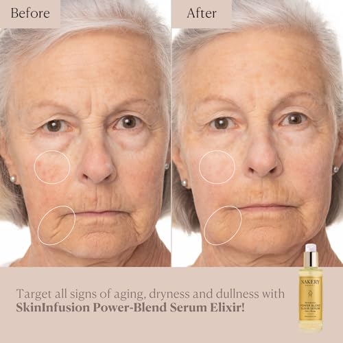 Nakery SkinInfusion Facial Oil Serum (5.07 Fl Oz), Anti Aging Collagen Serum with Hyaluronic Acid, Matrixyl 3000 and Vitamin C Oil, Moisturizing Brightening Treatment for Dark Spots and Dry Skin