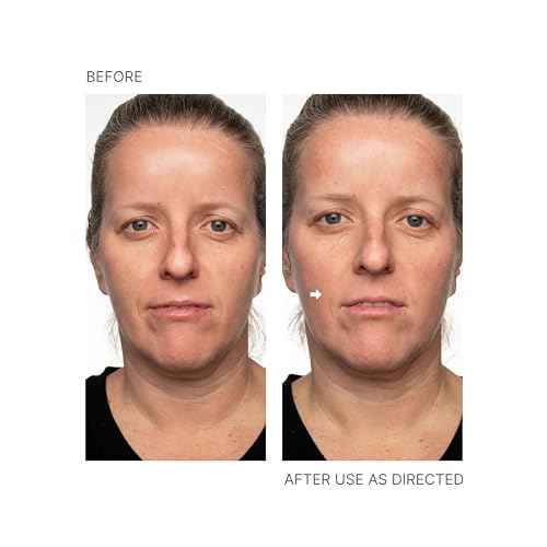Nu Skin - Face Lift with Activator (Original Formula) | Helps Lift and Tighten Your Face and Neck for a Youthful, Firm Appearance, Reducing Lines and Wrinkles, Enhancing Skin Tone and Texture
