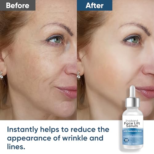 Instant Face Lift Serum, 2 Minute Temporary Skin Tightening Serum with Hyaluronic Acid, Visibly Lift & Firm Sagging Skin for Face & Neck, 1 Fl Oz (Pack of 1)