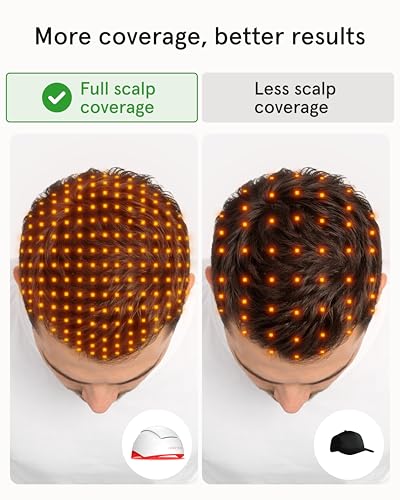 iRestore Pro Laser Hair Growth Cap - 282 Lasers & LEDs Therapy