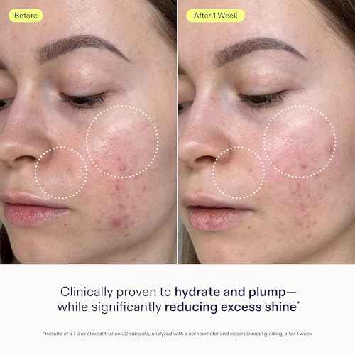 Skinfix Skin Barrier Restoring Gel Cream - 1.7 oz Refill - Non-Greasy Moisturizer for Normal to Combination Skin - Hydrates, Plumps & Smooths - Non-Comedogenic, Fragrance Free, Vegan, Cruelty Free