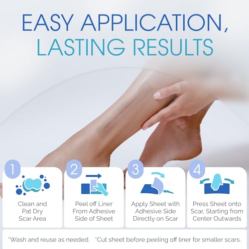 7¡± Medical Grade Reusable Silicone Scar Sheets for Surgical Scars & Stretch Marks ? Water-Resistant Breathable Silicone Scar Strips, 12-Pack (Approx. 90-Day Supply)