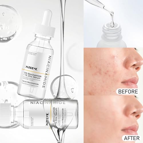 Niacinamide 10% + Zinc 1% Face Serum for Girls & Women, Moisturizing Niacinamide Serum for Acne, Redness.