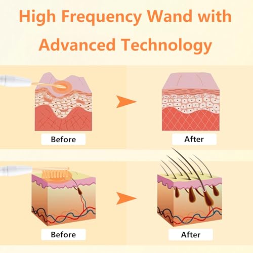 High Frequency Facial Wand for Face Skin Care