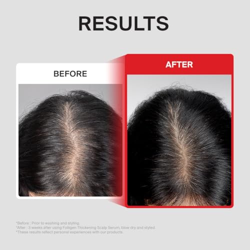 Dr.FORHAIR Folligen Thickening Scalp Serum 1.7 oz - Biotin & Peptide Hair Density Treatment