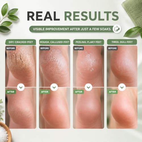 HEAMAVIN Tea Tree Oil Foot Soak with Epsom Salt & Botanical Oils, 16 oz