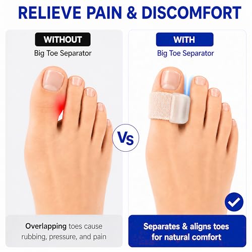Big Toe Spacers for Bunion Pain Relief | Hallux Valgus Corrector