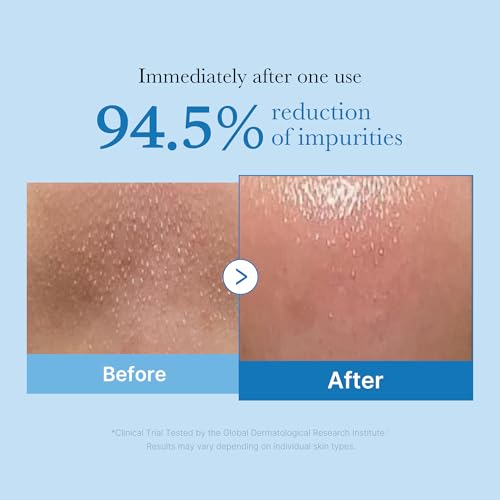 medicube Zero Pore Cleansing Oil | Makeup Remover & Blackhead Control