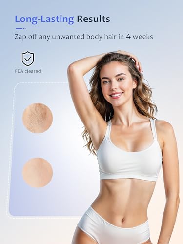 Ubroo Laser Hair Removal Device - White, 2 Session Hair Reduction