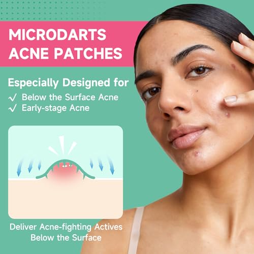 72-Count Microdart Acne Patches, Hydrocolloid Pimple Patches with Salicylic Acid & Madecossoside, Microdart Zit Patches for Deep Blemishes & Early Stage Acne (Patented)