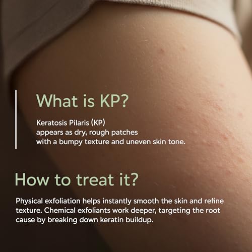 Glycolic Acid Body Wash for Keratosis Pilaris Treatment 7.5oz(Made In USA)Lactic Acid Body Exfoliator Cleanser for Rough & Bumpy Skin- KP Treatment for Arms,Legs- Exfoliating Body Wash for Smooth Skin