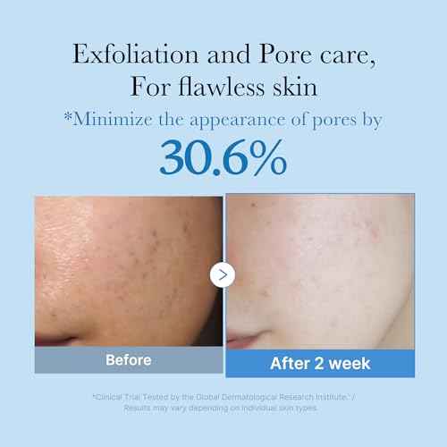 medicube Zero Pore Toner I Exfoliating & Hydrating Blue Bottle Water Toner with AHA, BHA, PHA, Niacinamide, and Panthenol | Korean Skin Care for Pores, Texture, and Moisture Care (8.45 fl. oz.)