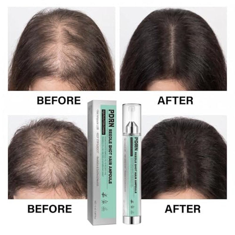 PDRN Reedle Shot Hair Ampoule for Thinning Hair - 15ml