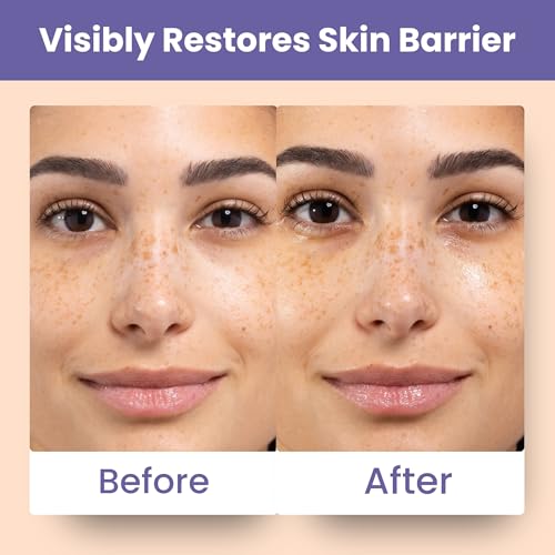 Patchology Skin Remedy Barrier-Boosting Sheet Mask ? Single Use Face Mask with Ectoin, Ceramides & Probiotics ? Hydrates, Protects & Nourishes ? Suitable for Sensitive & All Skin Types