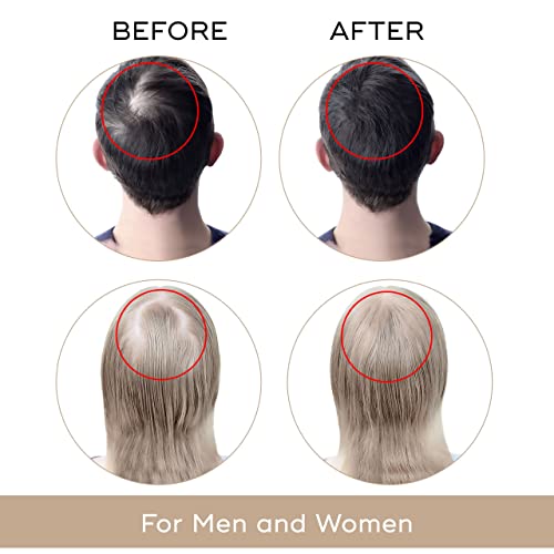 Charismo DEKOHAIR Scalp & Hair Serum | Hair Growth & DHT Blocker