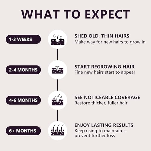 5% Minoxidil Hair Growth Serum for Women with Biotin - 15ML