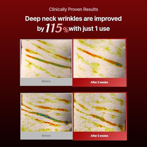 MEDITHERAPY Wrinkle-fit Neck Mask & Wrinkle-fit Face Mask + Facial Roller - Neck Wrinkle Patches, Neck Firming and Tightening Korean Deep Collagen Mask - Mesh Sheet Mask for Lifting Sagging Skin