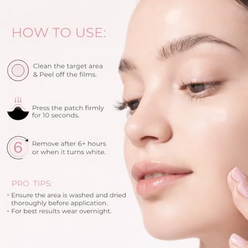 Pimple Patches ? Hydrocolloid Pimple Patch Spot Stickers for Acne and Whiteheads; Day or Nighttime Use; Fast Acting, Invisible Spot Treatment for Face and Skin- 72 Count