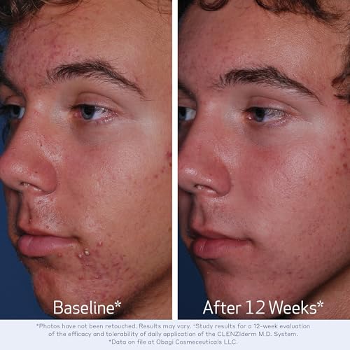 Obagi CLENZIderm M.D. Pore Therapy 2% Salicylic Acid Acne Treatment