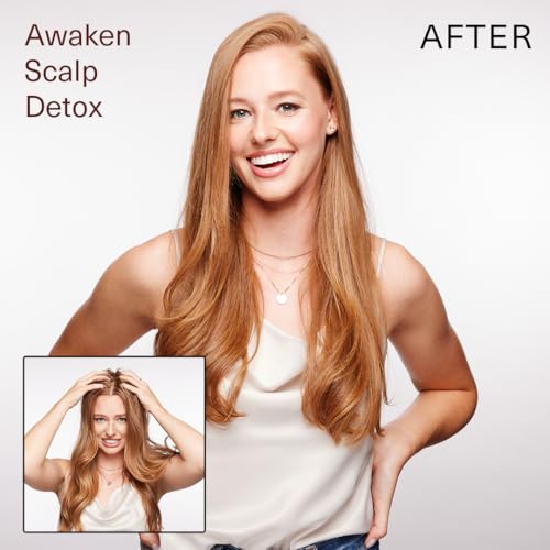 Surface Hair - Awaken Therapeutic Scalp Detox ? Natural Ingredients for Thinning Hair and a Healthy Scalp - 6 floz
