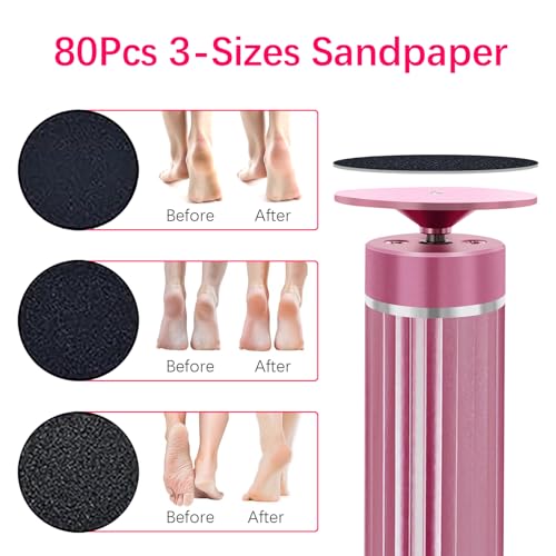 Electric Foot Callus Remover with 80 Sandpaper Discs & Brush