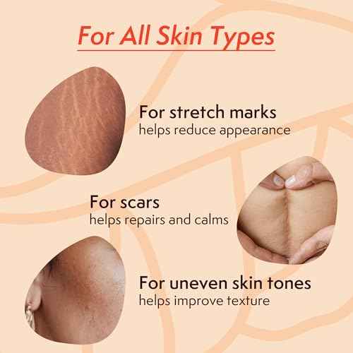 Nature Spell Stretch Mark Oil For Women, Vegan Body Oil for Stretch Marks, Scars & Uneven Skin Tone, 3.38 Fl Oz