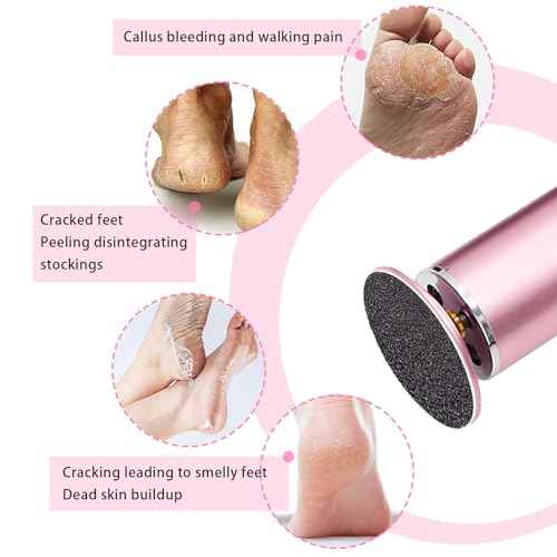 60 Pcs Sandpaper Set 1.7'' x 1.7'' for Electric Foot Callus Remover,Pedicure Disc,Sander Discs Replace Set - 1 Box (30 Fine Grit and 30 Coarse Grit)