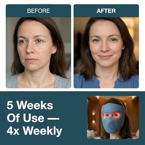 myhalos Red Light Therapy Face Mask | 360 LED, 4 Wavelengths