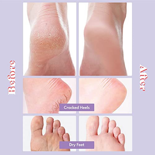 TOI:L Extra Silky Moisturizing Foot Mask Socks for Dry Feet (5 Pairs)