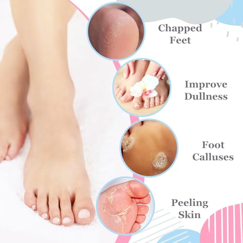 Cuffbow Silicone Moisturizing Socks - 4 Pairs for Dry Cracked Feet