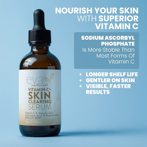 Vitamin C Serum for Face with Retinol & Salicylic Acid ? Skin Clearing Acne Spot Treatment with Niacinamide, Hyaluronic Acid, MSM ? Anti-Aging Facial Serum for Dark Spots and Blemishes, 2 Fl Oz