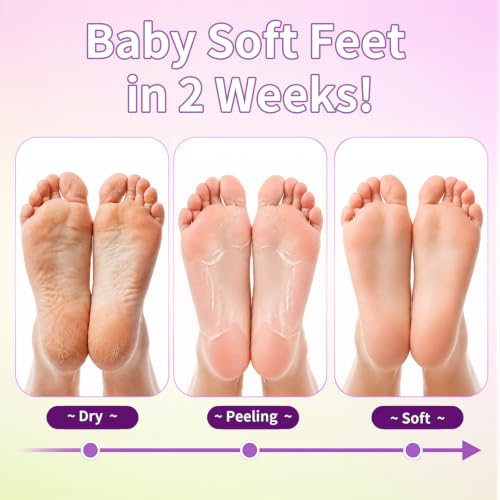 6 Pack Foot Peeling Mask for Soft, Smooth Feet - Exfoliate and Hydrate