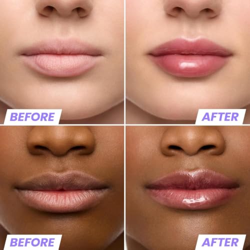 Wonderskin Lip Oil Rehab Serum Honey Tinted Hydrating Lip Oil for Soft & Glossy Lips