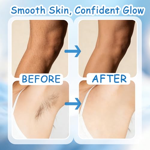 Wax Strips for Face, Waxing Strips, 40 Wax Strips for Hair Removal & 6 Calming Oil Wipes, Efficient Facial Wax Strips for Women Face, Lips, Body, Arms, Legs, Blue