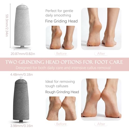 IRILEKI Pedicure Replacement Roller Heads – 6 Pcs for Electric Foot File & Callus Removers