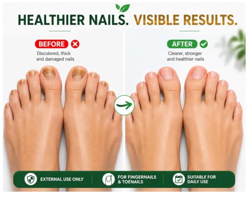 Nail Treatment 0.5oz - Healthy Nails Formula with Brush Applicator