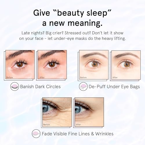 Retinol Under Eye Patches for Dark Circles & Puffiness - 24 Pairs