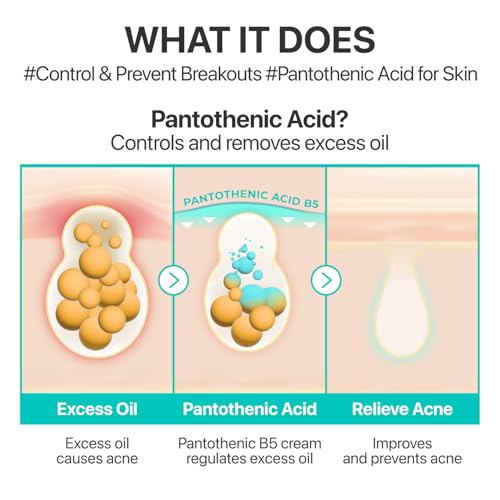 Numbuzin No.1 Pantothenic B5 Soothing Cream – Sebum & Acne Control
