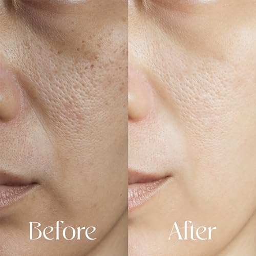 Turmeric Oil for Face and Body - Organic Makeup Remover with Antioxidant and Hydrating Properties, Fights Acne, Evens Tone